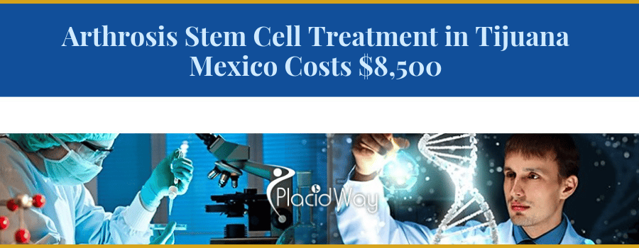 Arthrosis stem cell in Tijuana Mexico Cost